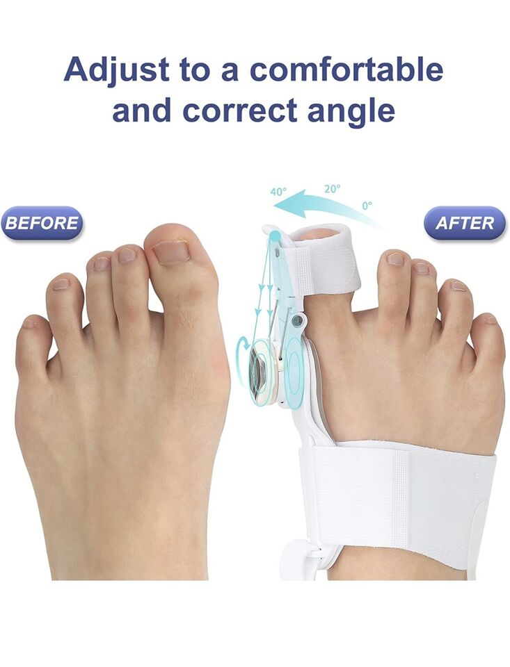 Alpha®️ Toe Corrector - 2.0